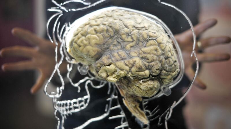 The team said the findings demonstrate manipulating memories to be easier than thought.