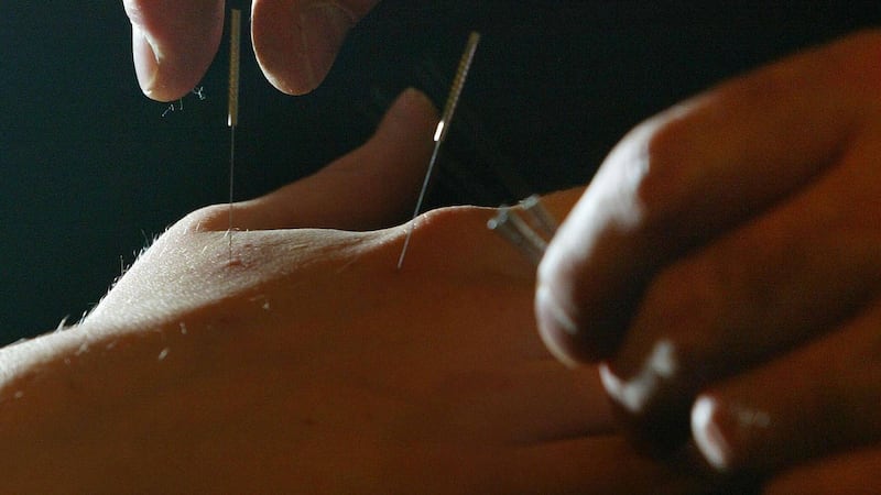 Acupuncture is a system of treatment using the insertion of needles into specific points on the body (David Cheskin/PA)