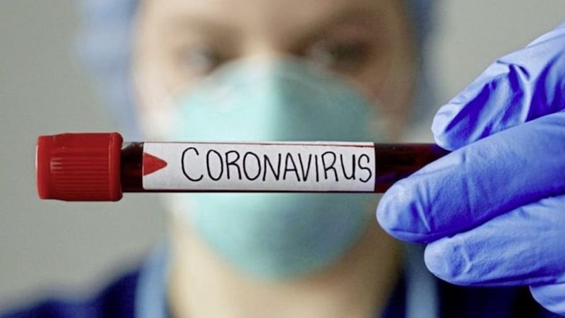 Another 514 people tested positive for Covid-19 in Northern Ireland 