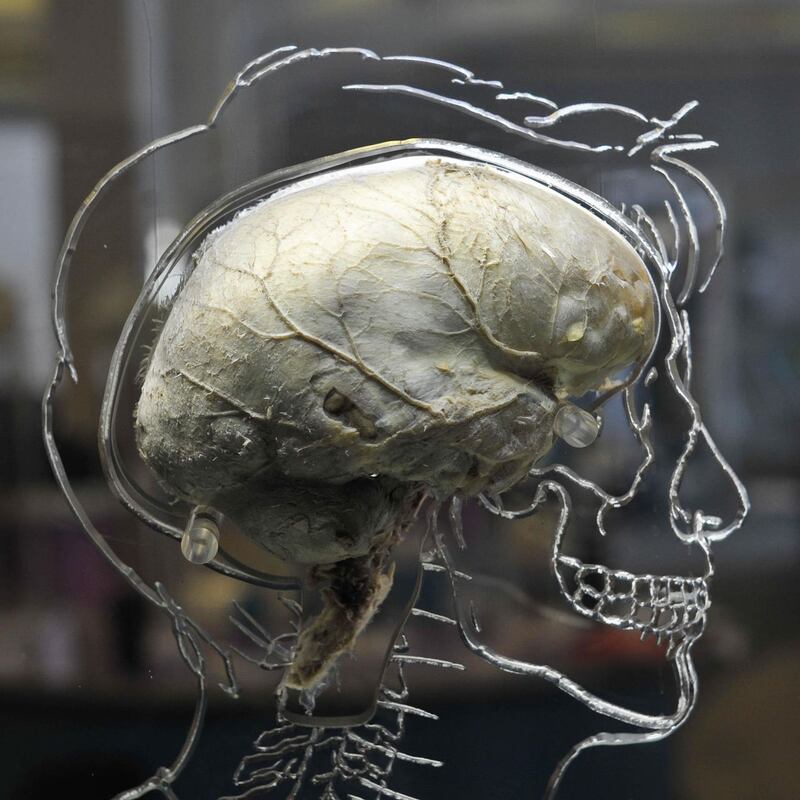 A human brain suspended in liquid with a to-scale skeleton, central nervous system and human silhouette carved into acrylic 