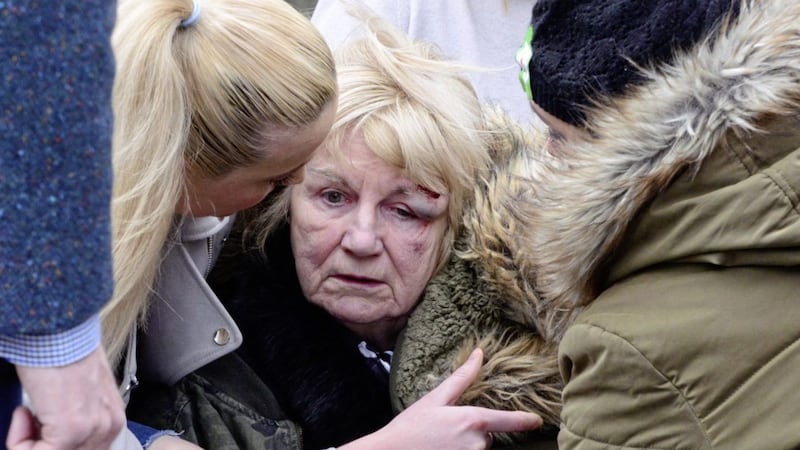 Lelia Quine (76) was hurt during the disturbances. Picture by Pacemaker Press