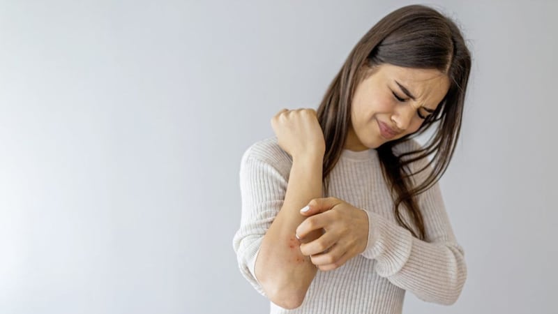 A protein plays a key role in itchy skin condition eczema, researchers say 
