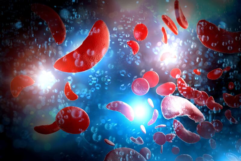 3D illustration of sickle cell disease blood cells