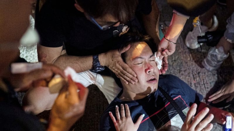 A man is helped by volunteers after getting caught by police pepper spray, near a demonstration in Hong Kong on Monday Picture by Felipe Dana/AP 