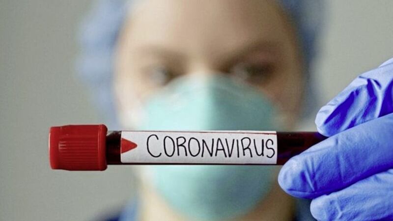 Almost 800 people tested positive for coronavirus in Northern Ireland 