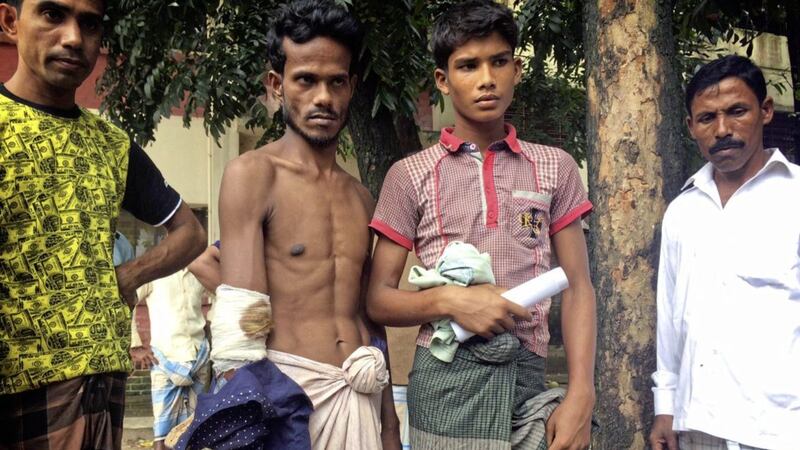 Mohammad Osama (16), centre right, and Amanullah (28), centre left, show their bullets wound outside Sadar hospital, in Cox Bazar,  Picture: Muneeza Naqvi/AP              