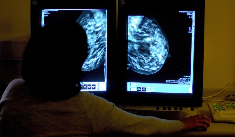 Researchers have made a potential breakthrough on breast cancer