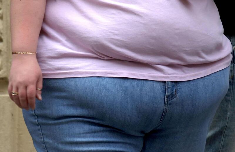 Obesity related hospital admissions soaring