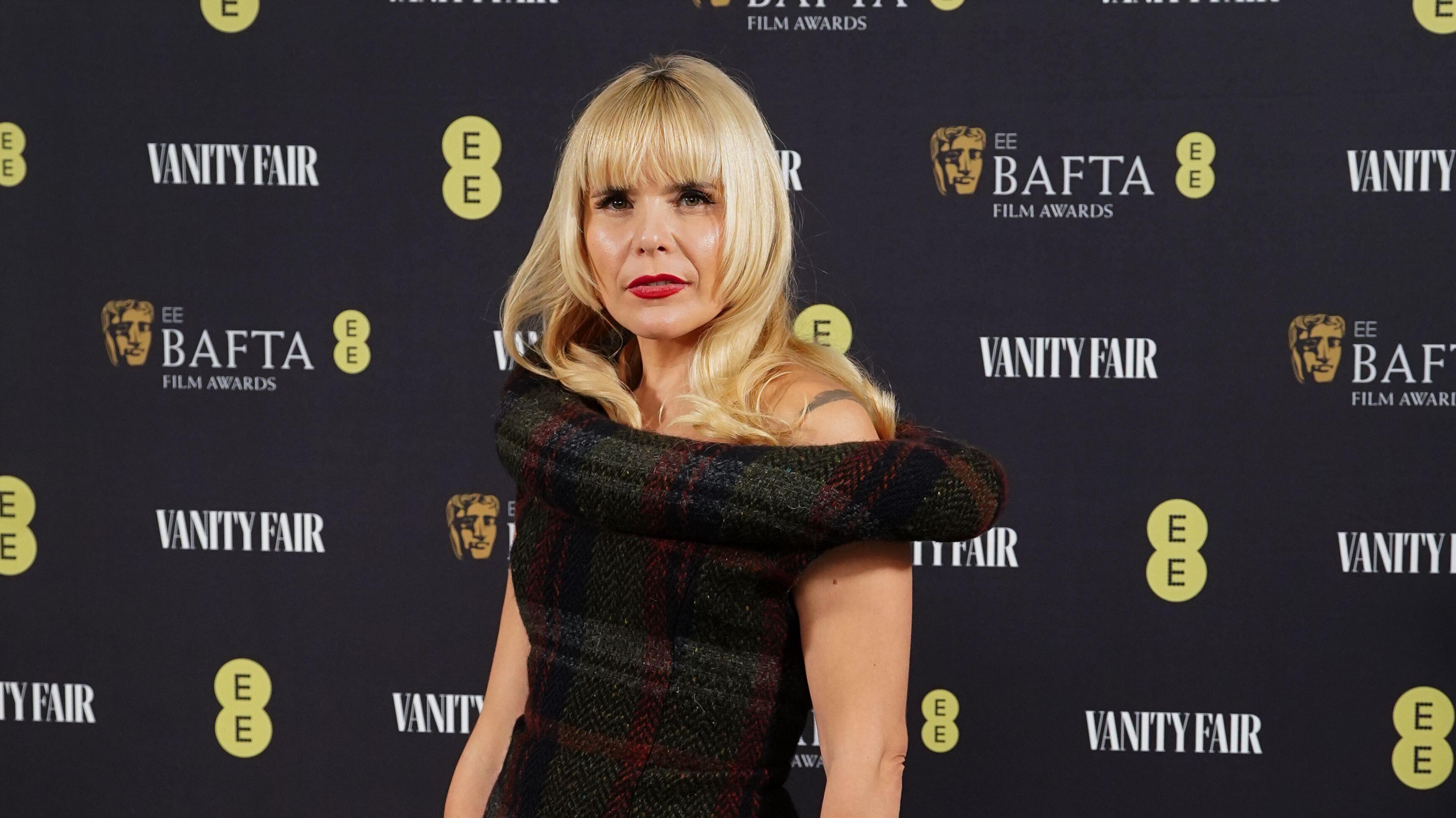 Singer Paloma Faith opens up about her stress-related hair loss