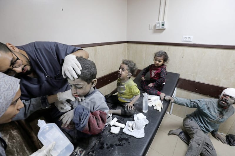 Palestinian children wounded in the Israeli bombardment of the Gaza Strip are treated at al Aqsa Hospital on Deir al Balah in Gaza this week. PICTURE: AP PHOTO/MARWAN SALEH 