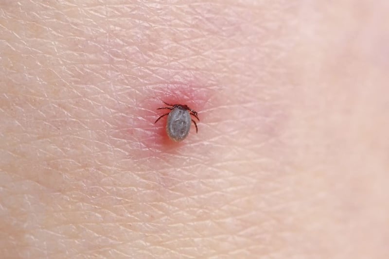 A tick feeding on human blood &ndash; Lyme disease can be spread via tick bites 