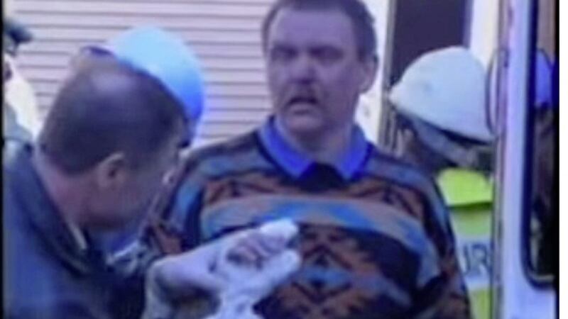 Geordie Brown pictured having his hands bandaged on the day of the Shankill bomb. 