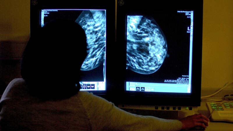 Charity Breast Cancer Care said it was a ‘life-changing breakthrough’.