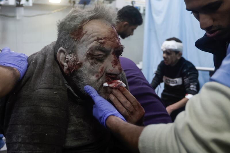 Palestinians wounded in an Israeli bombardment receive treatment at the hospital in Khan Younis refugee camp, southern Gaza Strip (Mohammed Dahman/AP)