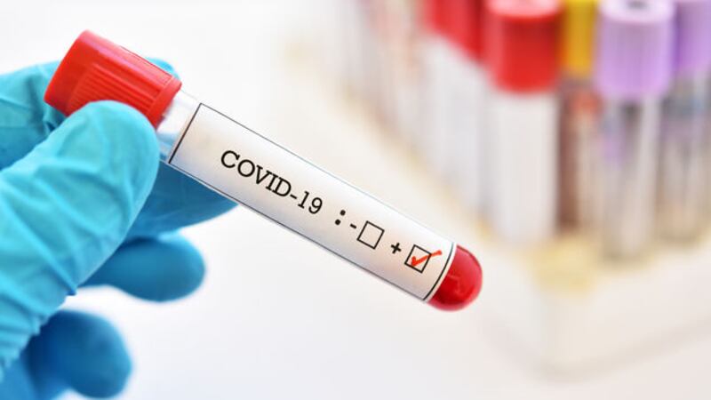 &nbsp;There have been another 92 cases of Covid-19 confirmed, taking the total in the Republic since the outbreak began to 24,048.