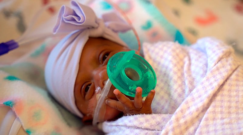 'Saybie' is believed to be the world's tiniest surviving baby 