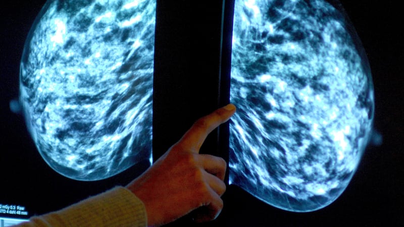 A new study suggests AI can be used safely in assessing breast cancer screening images (Rui Vieira/PA)
