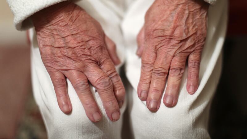 Osteoarthritis affects 15% of the global population over the age of 30 – study (Yui Mok/PA)