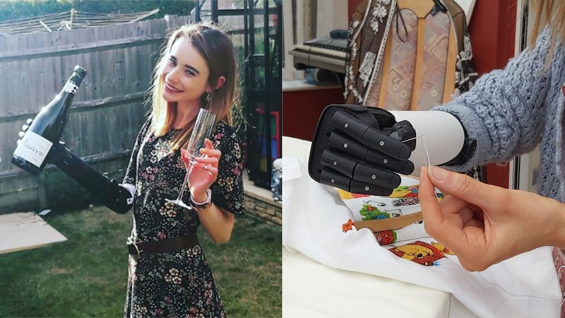 Vikki Smith has become the latest recipient of the advanced prosthetic arm.