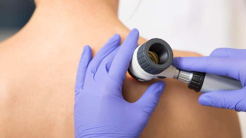 UK skin cancer cases have hit a record high (Alamy/PA)