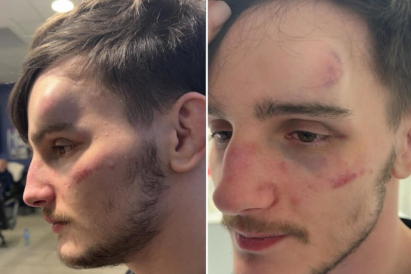 Mum says son ‘still in shock’ after gang attack at GAA club