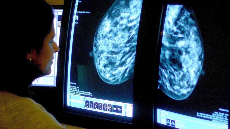 For every 100 women using oestrogen plus daily progestogen MHT, two extra cases of breast cancer were identified between age 50-69, study suggests.