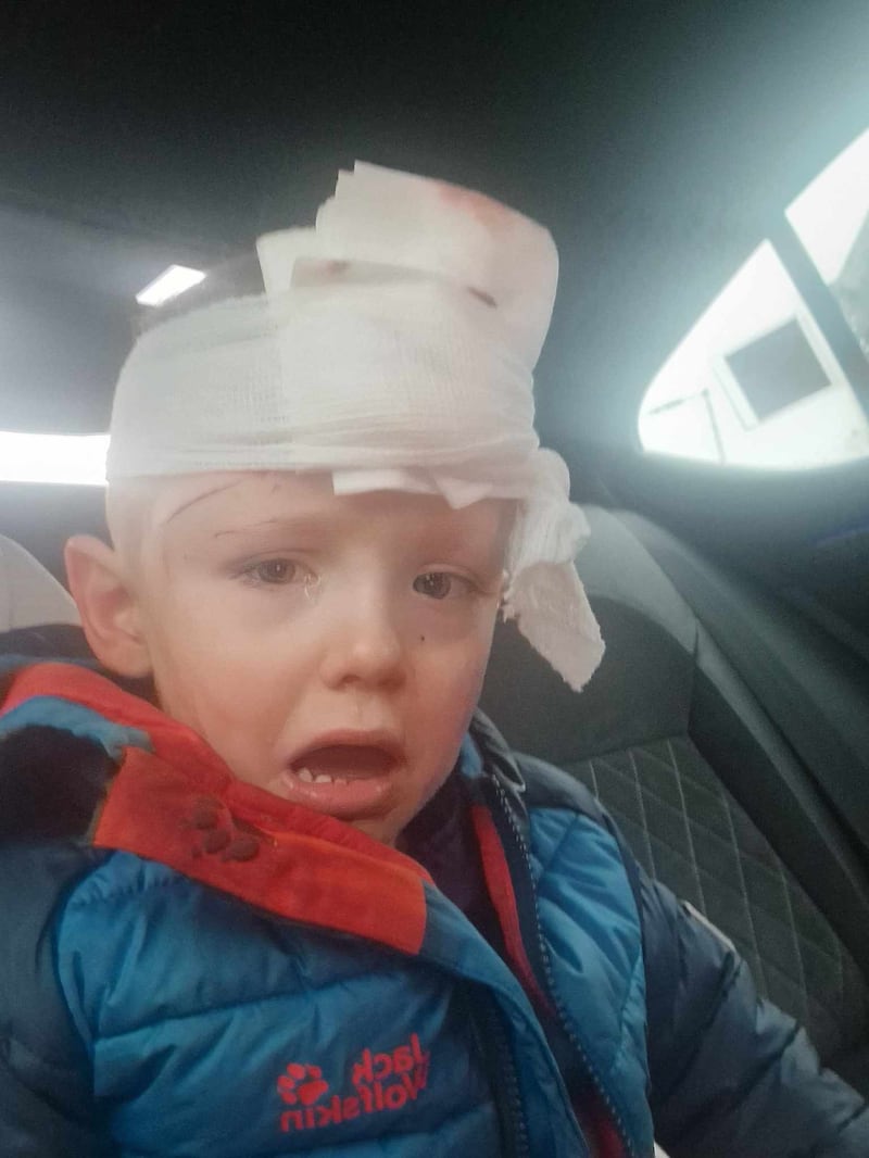 Little Keaghán pictured after being treated in hospital. PICTURE: ALICE-LEE BUNTING