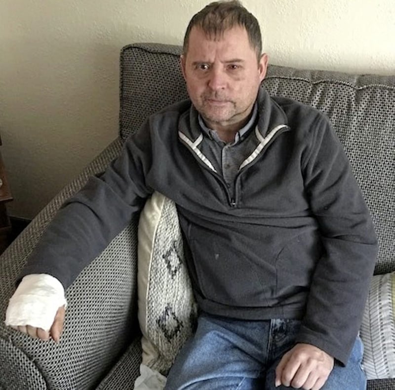 Cetlic fan Charlie Phelan from Derry's Bogside lost the sight in his left eye as a result of the attack