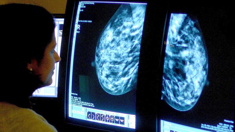 The researchers said the method gives a ‘clearer picture’ of breast cancer risk.
