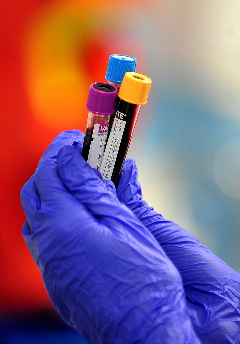 Proteins in blood could identify increased risk of cancer