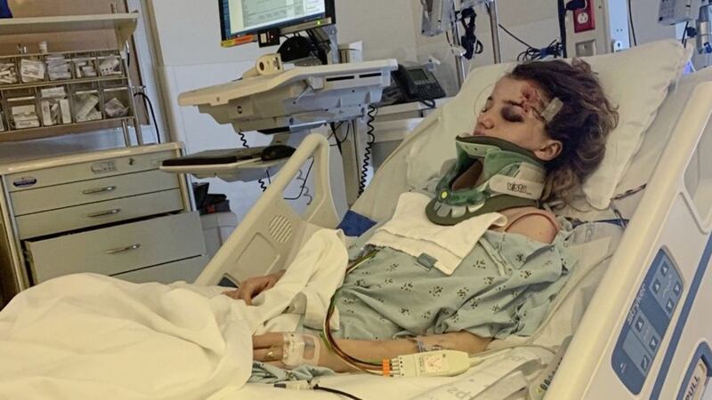 Karmen Curley from Newtownabbey pictured in intensive care in the US after she suffered multiple injuries in a scooter crash while on holiday in Los Angeles 