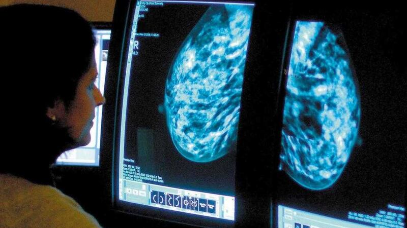 Two-week targets for urgent breast cancer referrals were massively breached in the Belfast trust in January, where just nine per cent of patients seen during the first half of the month. 