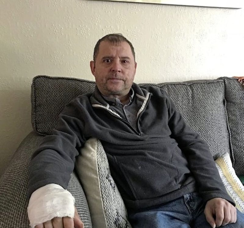 Cetlic fan Charlie Phelan from Derry's Bogside lost the sight in his left eye as a result of the attack.