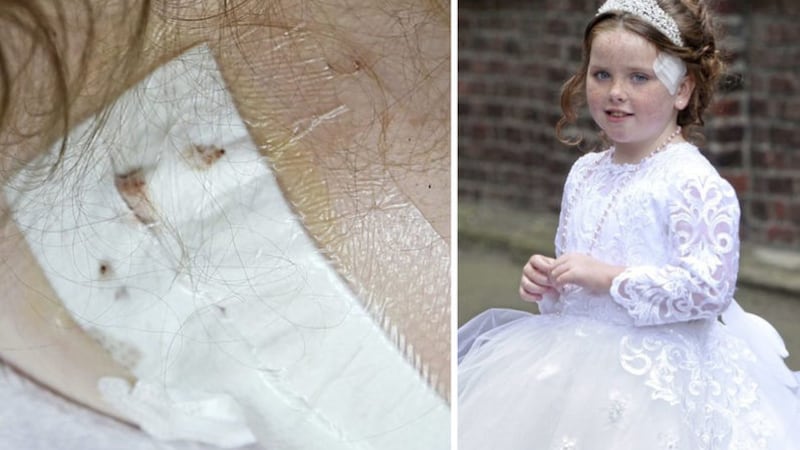 Annie McFadden (8) made her First Holy Communion at St Patrick's Church in Belfast yesterday, a week after she suffered a catalogue of injuries(left) when she was attacked by a dog in north Belfast&nbsp;