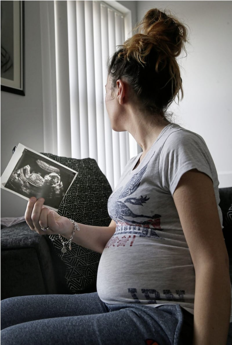 Laura Knox holds a picture of her unborn baby. Picture by Hugh Russell. 