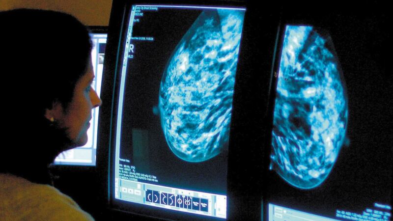 A consultant analysing a mammogram for signs of breast cancer. Picture by Rui Vieira, Press Association&nbsp;