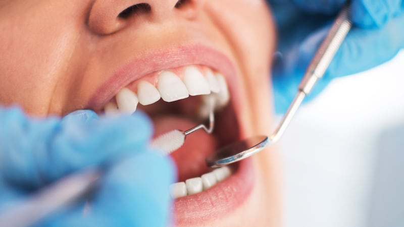 Over one million dental appointments have been lost since lockdown, according to new figures