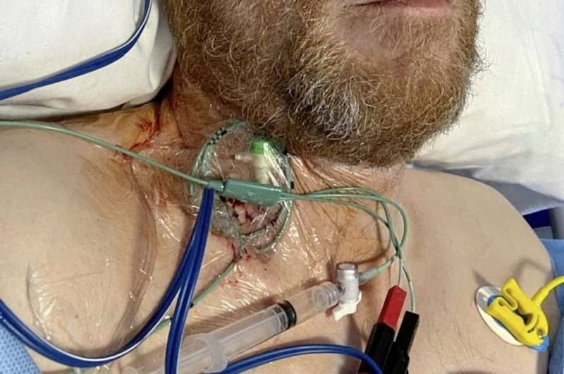 Assembly member Philip McGuigan recently had a temporary pacemaker fitted and posted images of his medical emergency on social media 