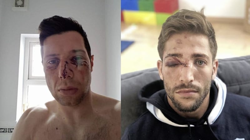 Former Tyrone captain Sean Cavanagh (left) and professional rugby player Teddy Iribaren (right) ended up with similarly busted-up faces as a result of their sporting endeavours at the weekend. But while video footage showed Iribaren&#39;s was an accident, the lack of evidence from the other incident means judgement must be reserved. Pictures: Twitter 