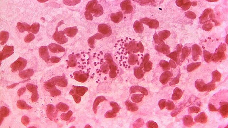 The number of gonorrhoea diagnoses has risen to the highest in any one year since records began in 1918 (CDC/PA)