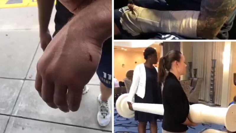 Carl Frampton posted photos online of his injured hand and staff from the hotel moving the large ornament that injured him. Pictures: Carl Frampton/Twitter