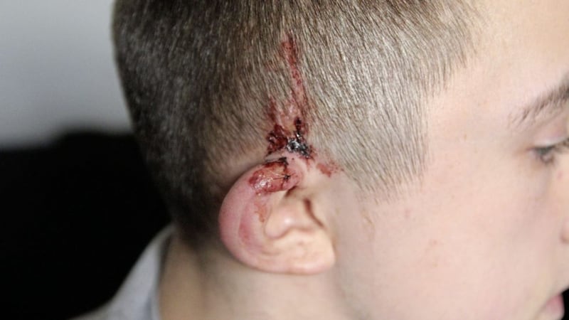 Robert Holmes suffered head injuries in the attack 