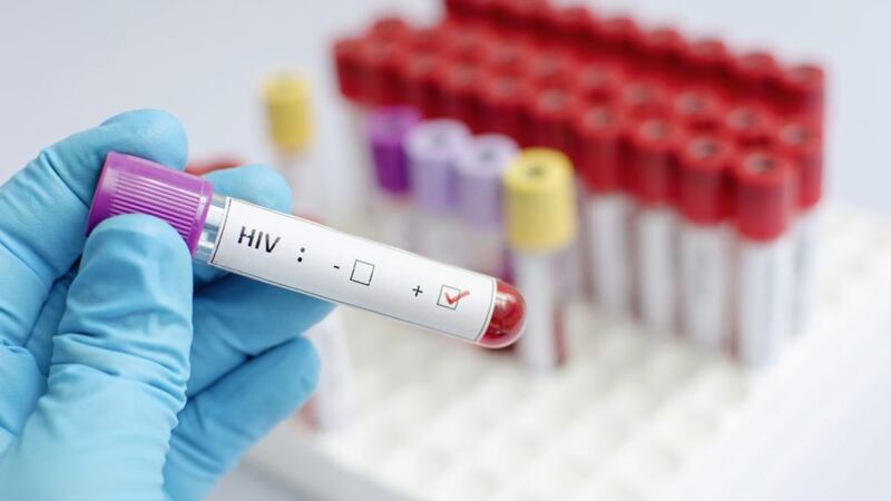 Around 100 new cases of HIV are diagnosed in Northern Ireland every year 