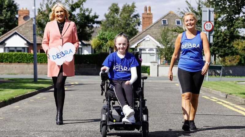 Claudia Scanlon is raising funds for Debra Ireland, a charity that supports those with a condition known as butterfly skin.