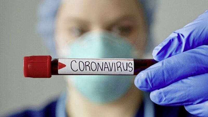 <span style="color: rgb(51, 51, 51); font-family: sans-serif, Arial, Verdana, &quot;Trebuchet MS&quot;; ">The latest figures take the total number of coronavirus-linked deaths recorded by Nisra to 3,100</span>