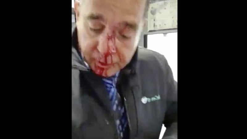 A Translink worker in the aftermath of Friday&#39;s assault on a train 