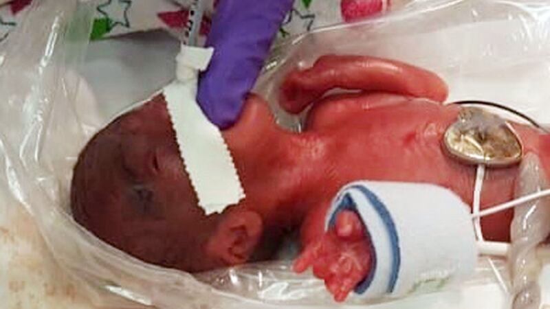 The girl weighed just 8.6 ounces when she was born in December.