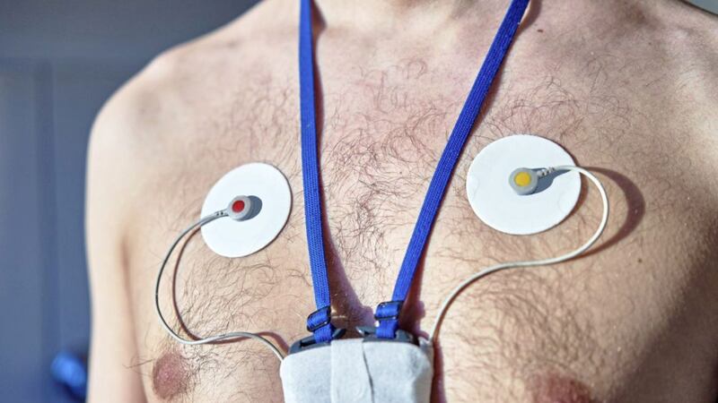 Doctors need to capture and identify the rhythm of your heart using a 24-hour ambulatory ECG recording 