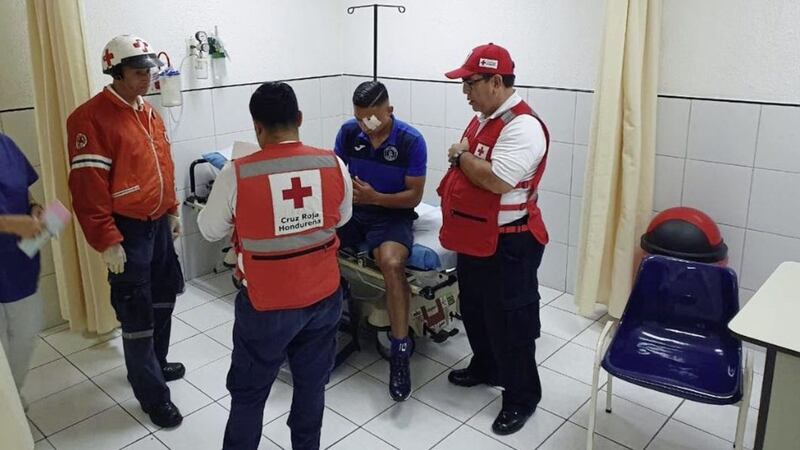 Emilio Izaguirre was injured in the clashes. Picture by Motagua Football Club 