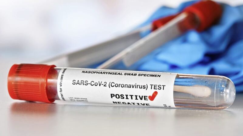 <span style="color: rgb(51, 51, 51); font-family: sans-serif, Arial, Verdana, &quot;Trebuchet MS&quot;; ">There were two coronavirus deaths in the latest week subjected to analysis by the Northern Ireland Statistics and Research Agency</span>